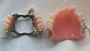 chrome denture